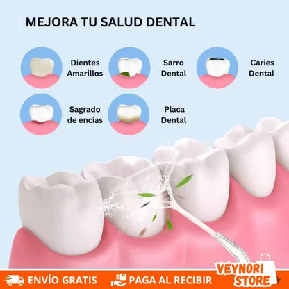 OralFlow® - Irrigador Bucal Recargable Inalámbrico